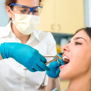 Tooth Extraction